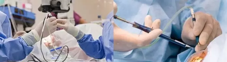 Intervento chirurgico per ripristinare la vista